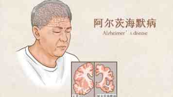 不拘一格选人才